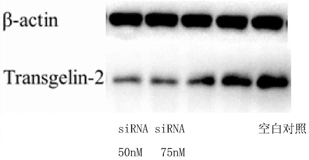 Uses of actin binding protein 2 in smooth muscle dysfunction disease treatment drug screening