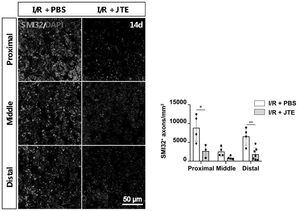 Application of JTE-013 in preparation of medicine for protecting glaucoma optic nerve injury