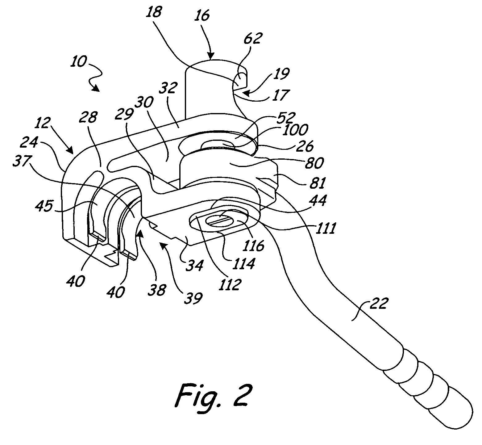 Threaded fulcrum clamp