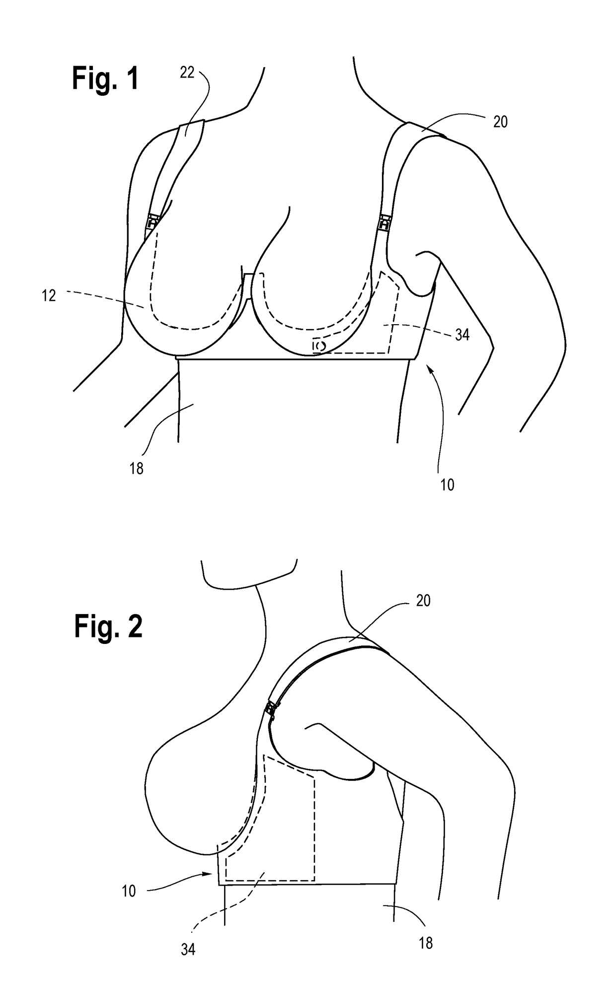 Post-Surgical Breast Molding Device