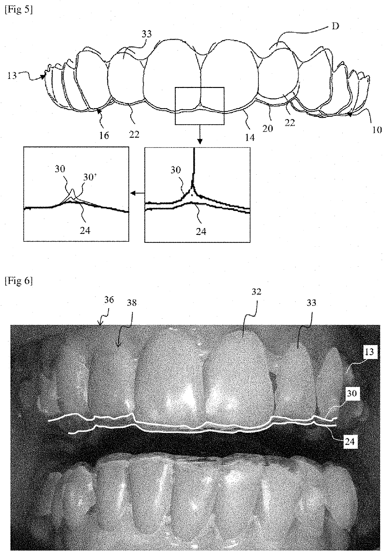 Method for evaluating an orthodontic aligner