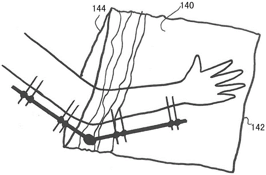 Wound care device