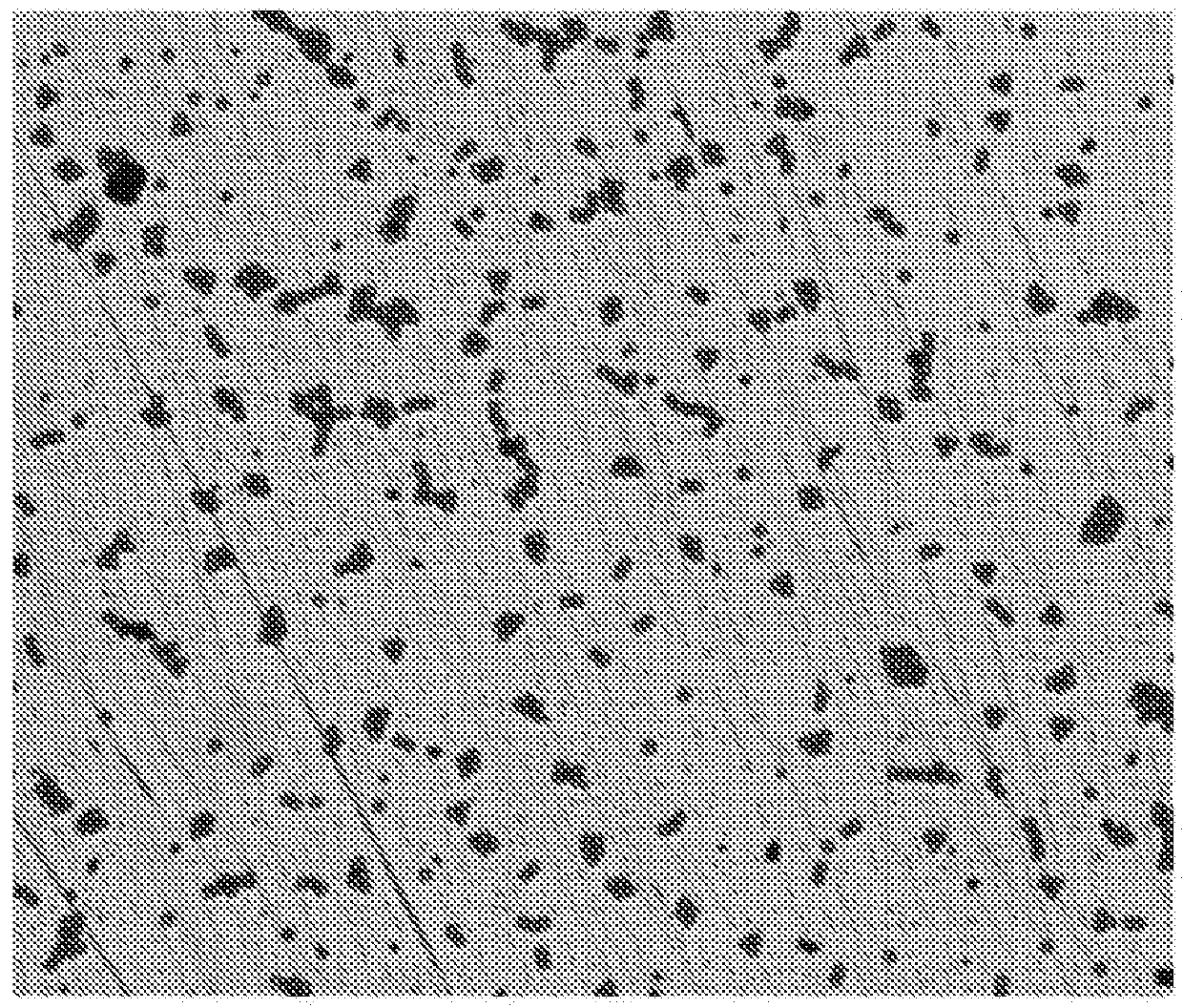 Image Segmentation Method Based on Watershed Algorithm and Morphological Labeling