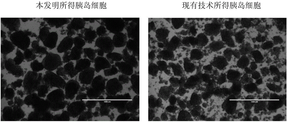 A kind of injection preparation before islet extraction from newborn pig pancreas