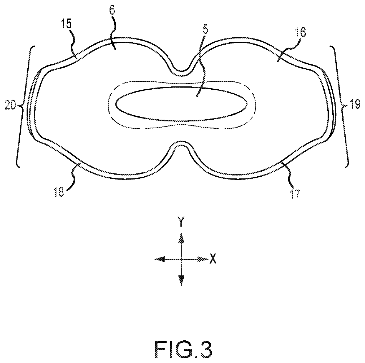 Oral and nasal devices for the treatment of sleep apnea and/or snoring with filter and sensors to provide remote digital monitoring and remote data analysis