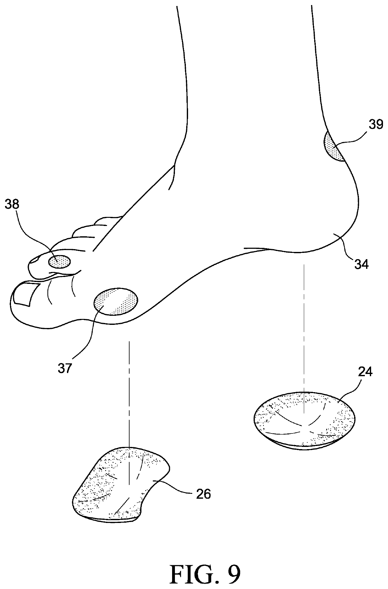 Foot prosthetic