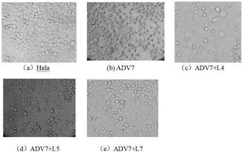 Polyiodinated aromatic acid compound and application thereof in resisting adenovirus type 7