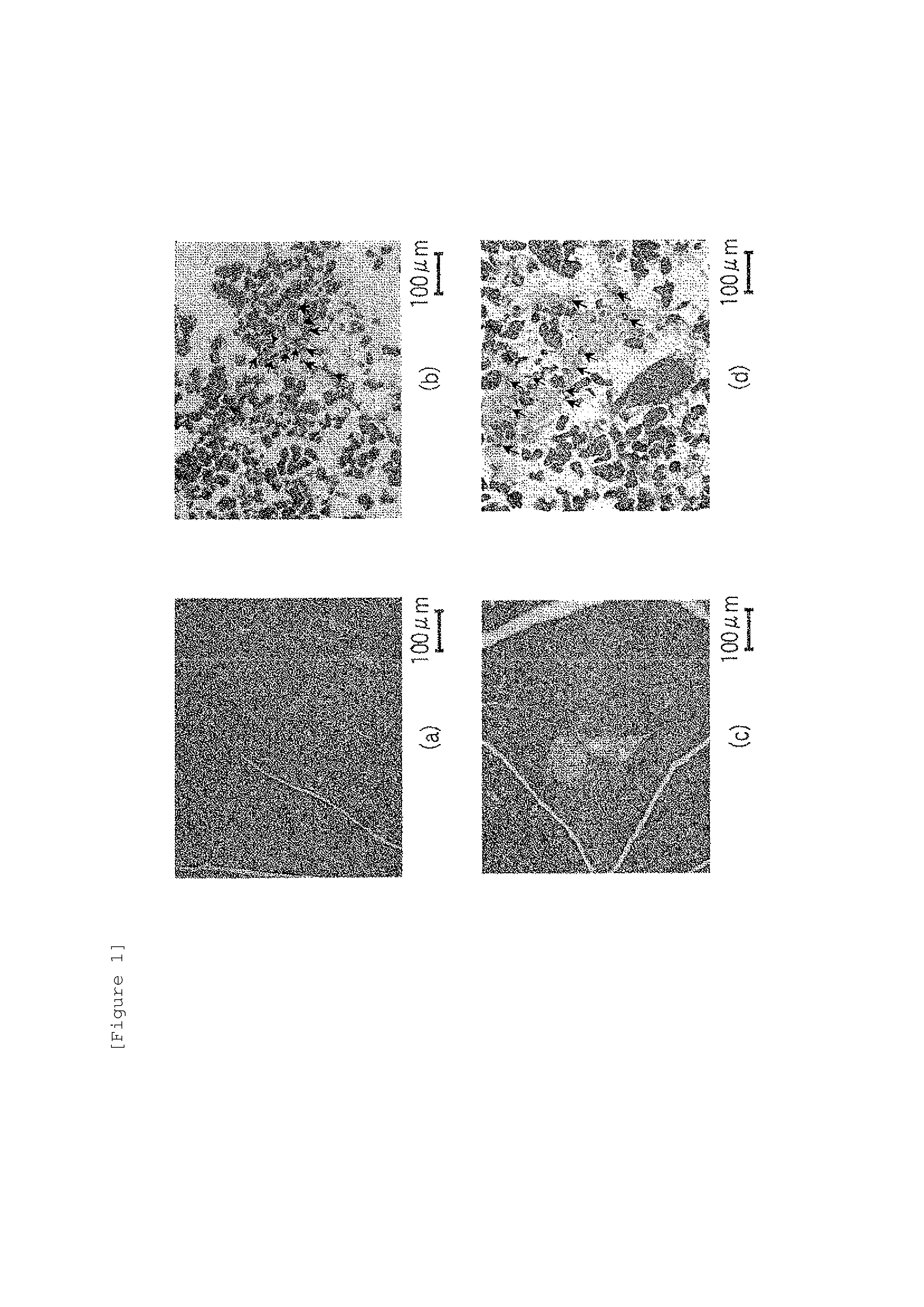 Pancreatic islet separation method, and protective solution for protecting pancreatic islet tissue