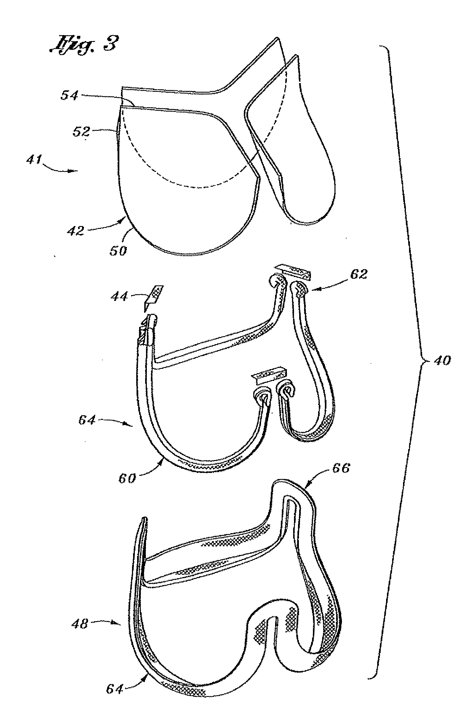 Flexible heart valve and associated connecting band