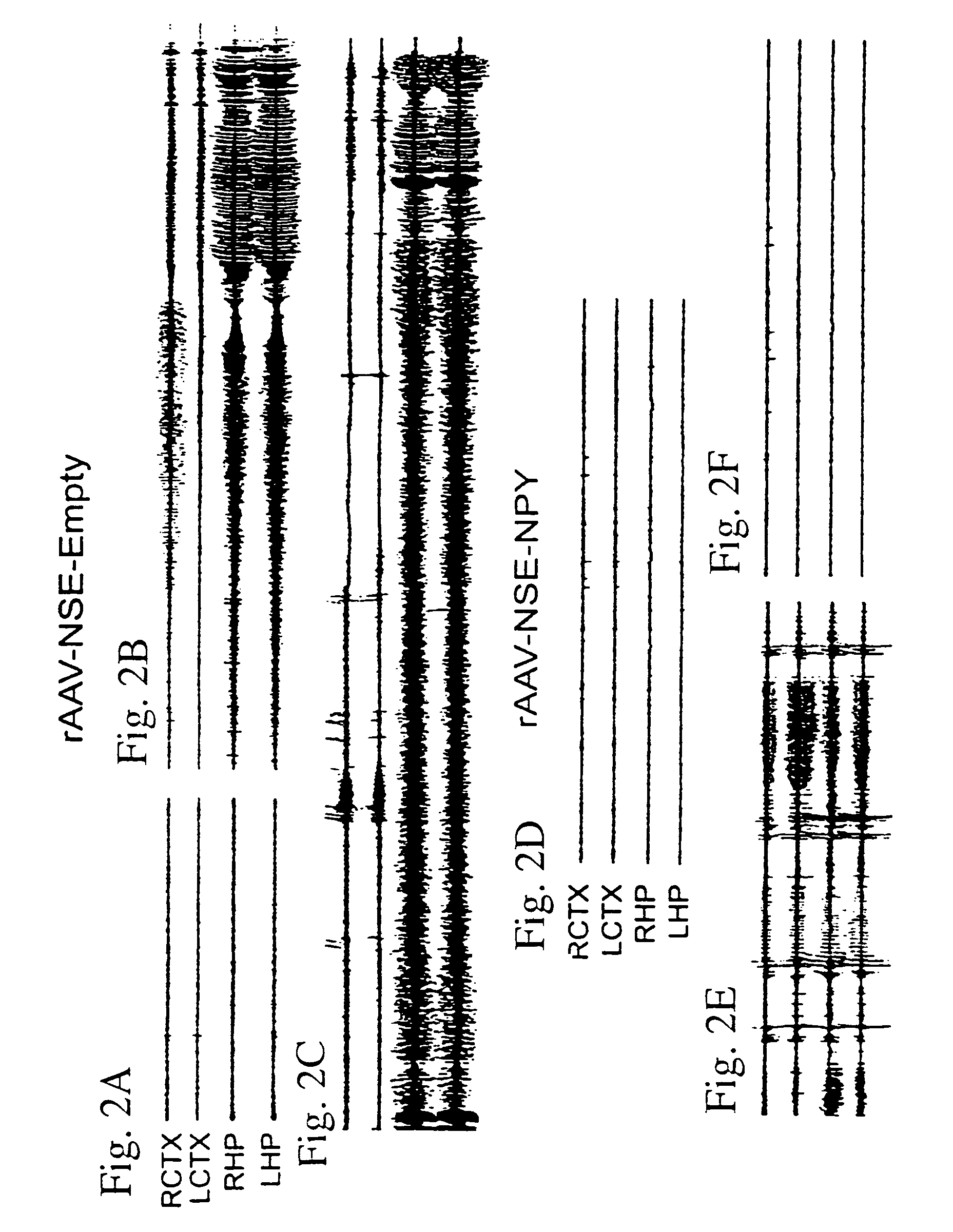 Methods and compositions for the treatment of neurological disease