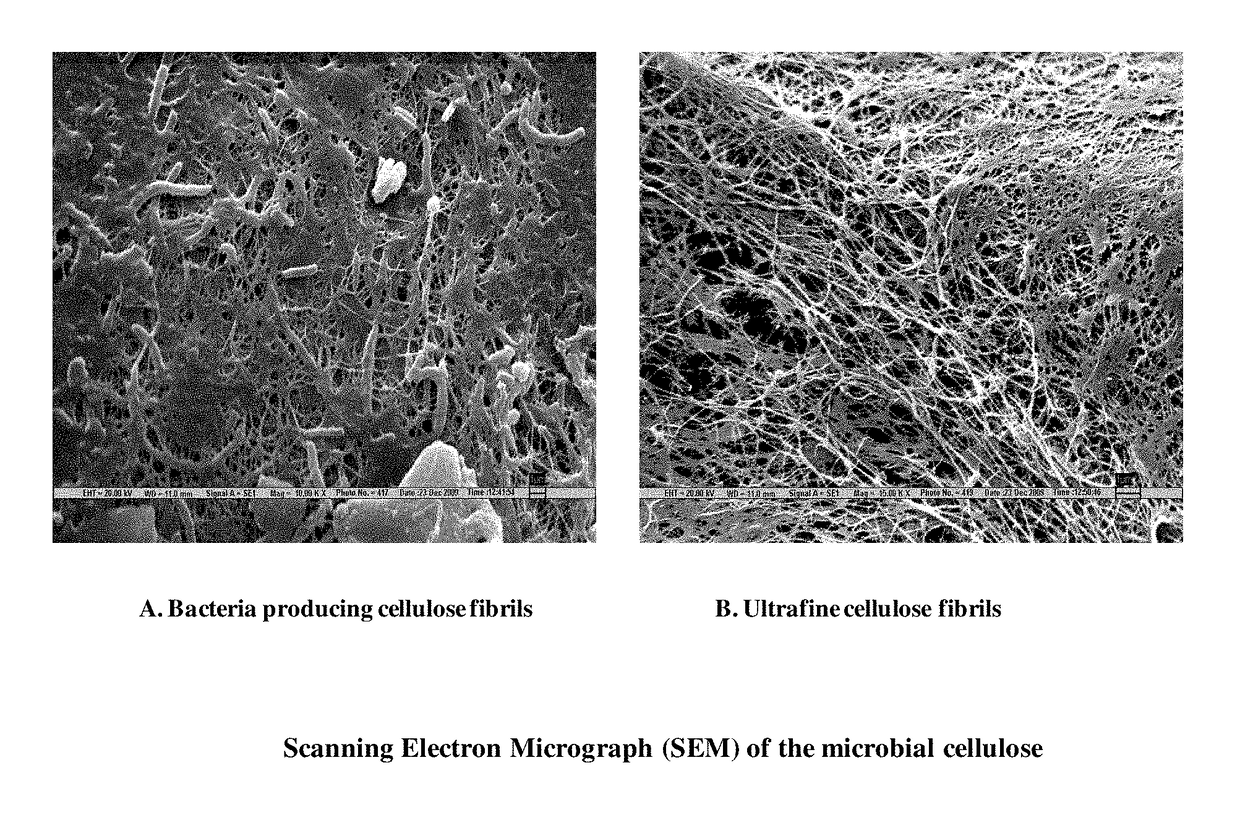 Isolated bacterial strain of gluconacetobacter oboediens and an optimized economic process for microbial cellulose production therefrom