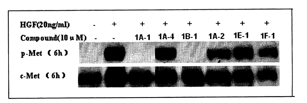 Quinoline compound and preparation method thereof, medicament combination containing compound and application of compound