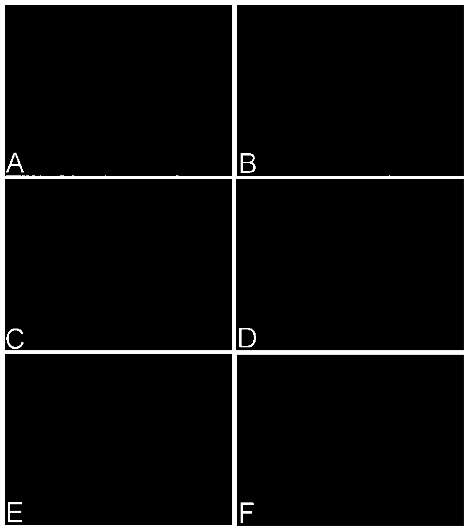 Six2 genetic expression-inhibiting shRNA, lentiviral expression vector and construction method of lentiviral expression vector