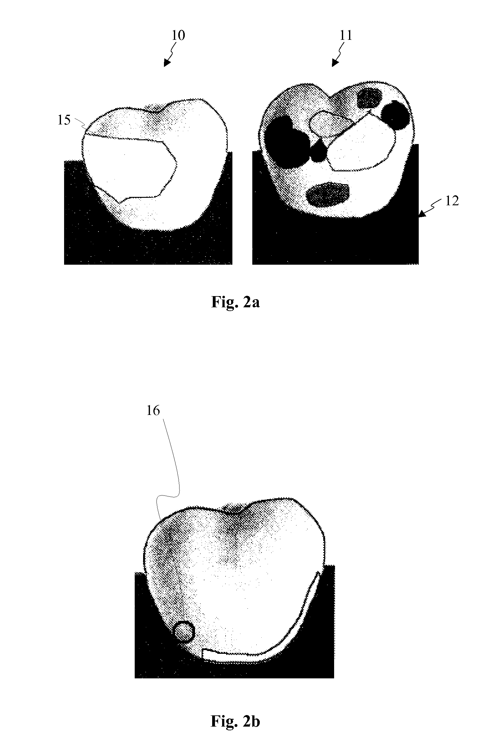 Method and device for measuring the efficacy of plaque removal