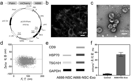 Delivery system of biomimetic modification of cerium oxide nanoparticles by exosomes and its application in hair cells