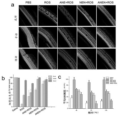 Delivery system of biomimetic modification of cerium oxide nanoparticles by exosomes and its application in hair cells