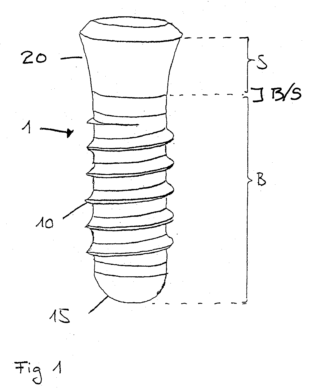 Two-Part Implant with a Hydroxylated Soft Tissue Contact Surface