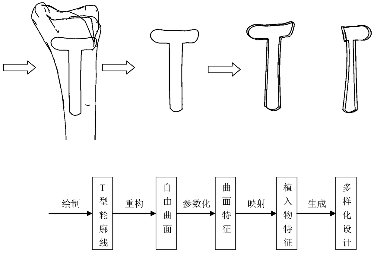 Diversified design method of tibial T-shaped bone plate based on parametric technology