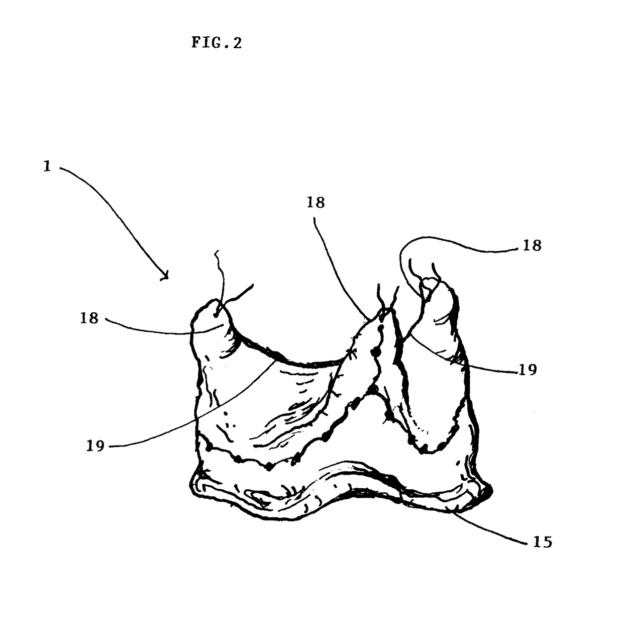Pericardial heart valve replacement and methods of constructing the same