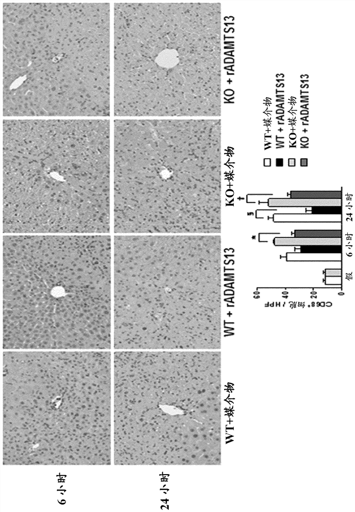 Diagnostics and pharmaceuticals containing adamts13 as a main ingredient