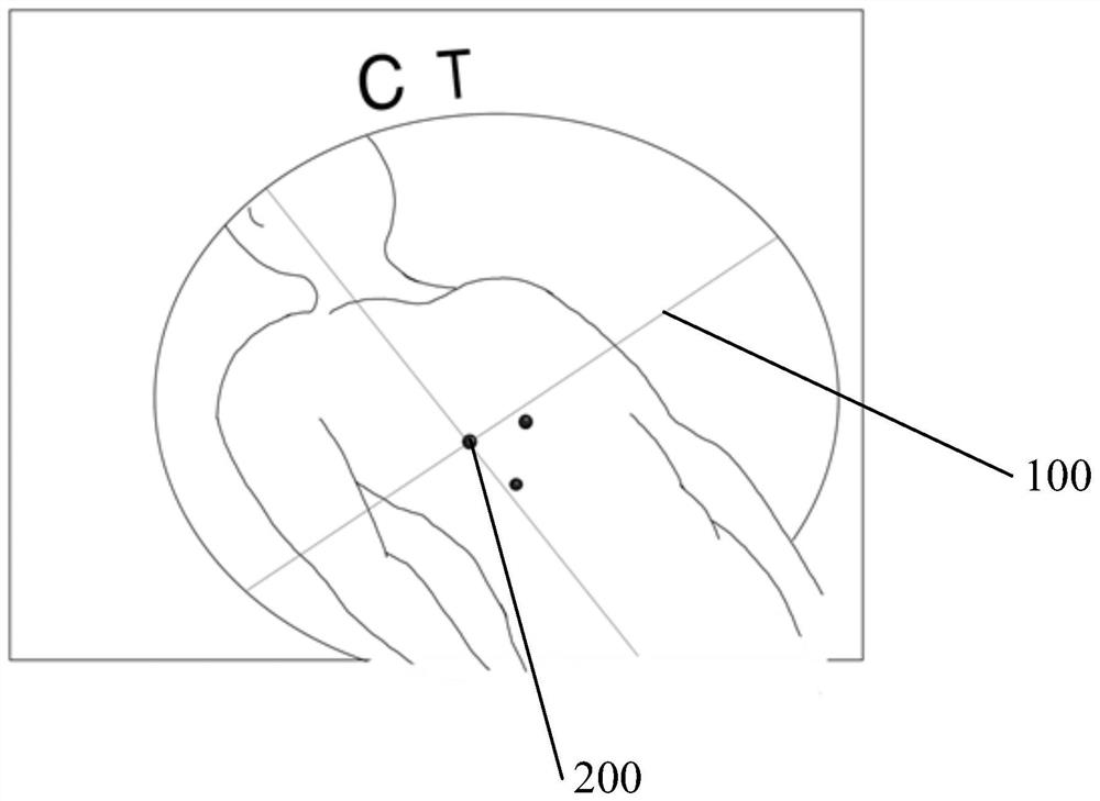 Surgical guidance model, head-mounted wearable device-assisted surgical navigation system
