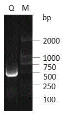 Fusion protein SUMO1-PLA2, and preparation method and medical use thereof