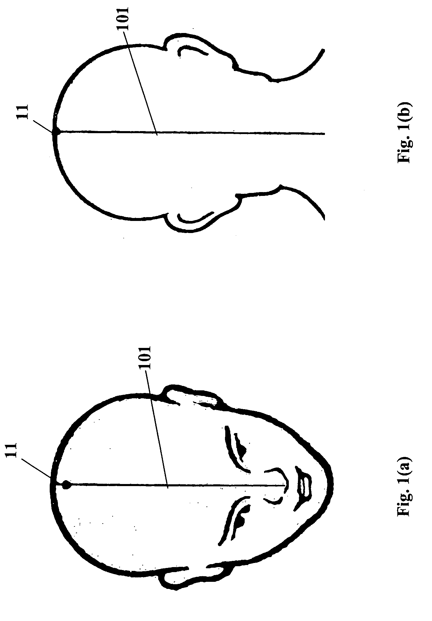Acupressure device for treating insomnia