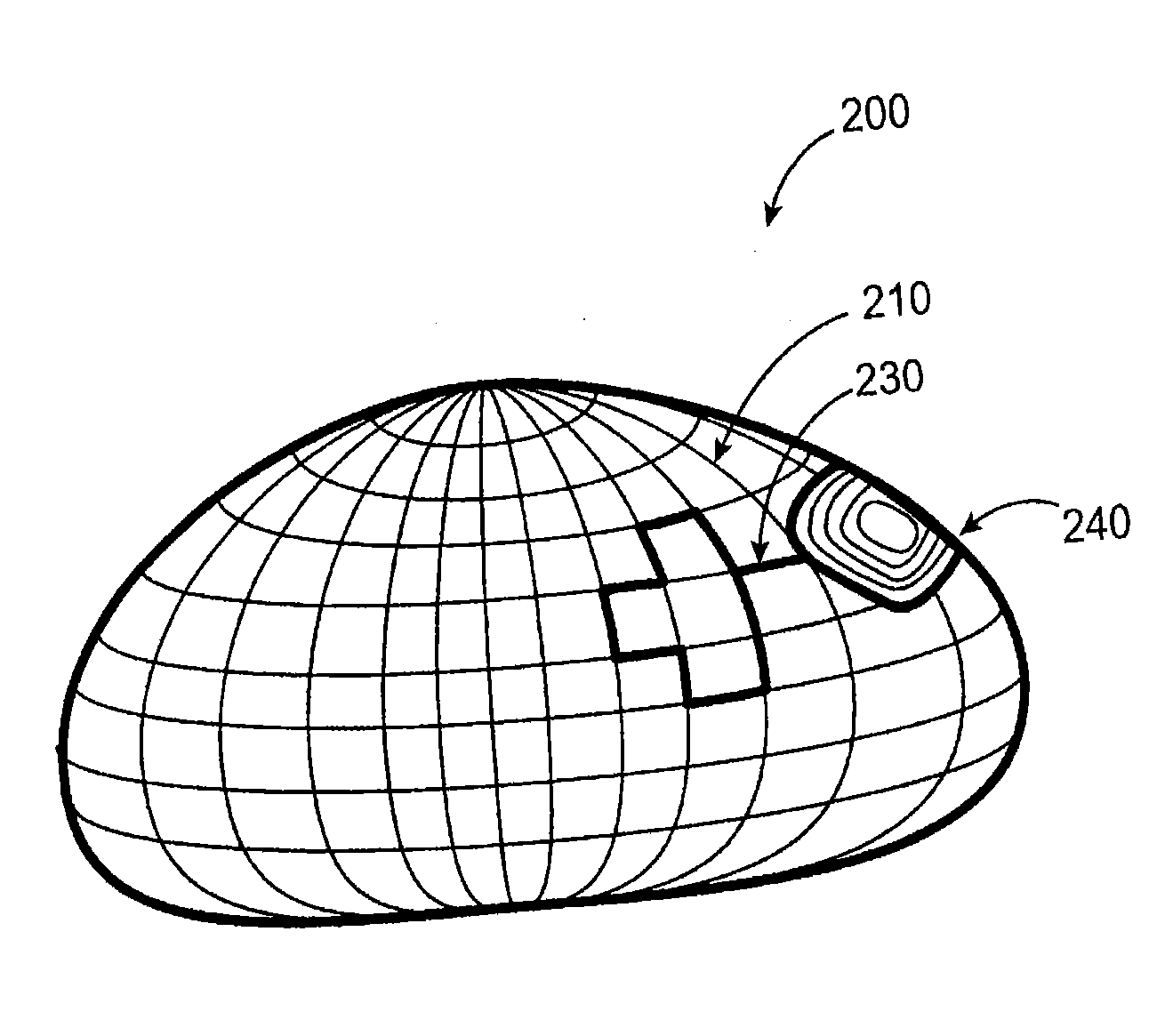 Methods,device,and systems for obesity treatment