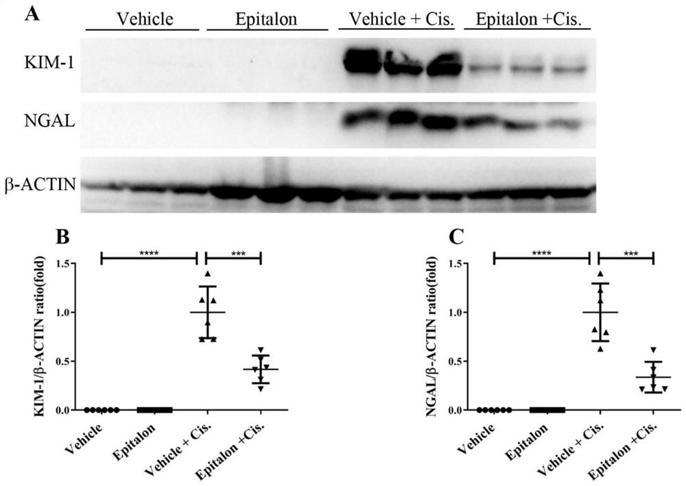 Application of Epitalon in preparation of medicine for relieving cisplatin-induced acute kidney injury