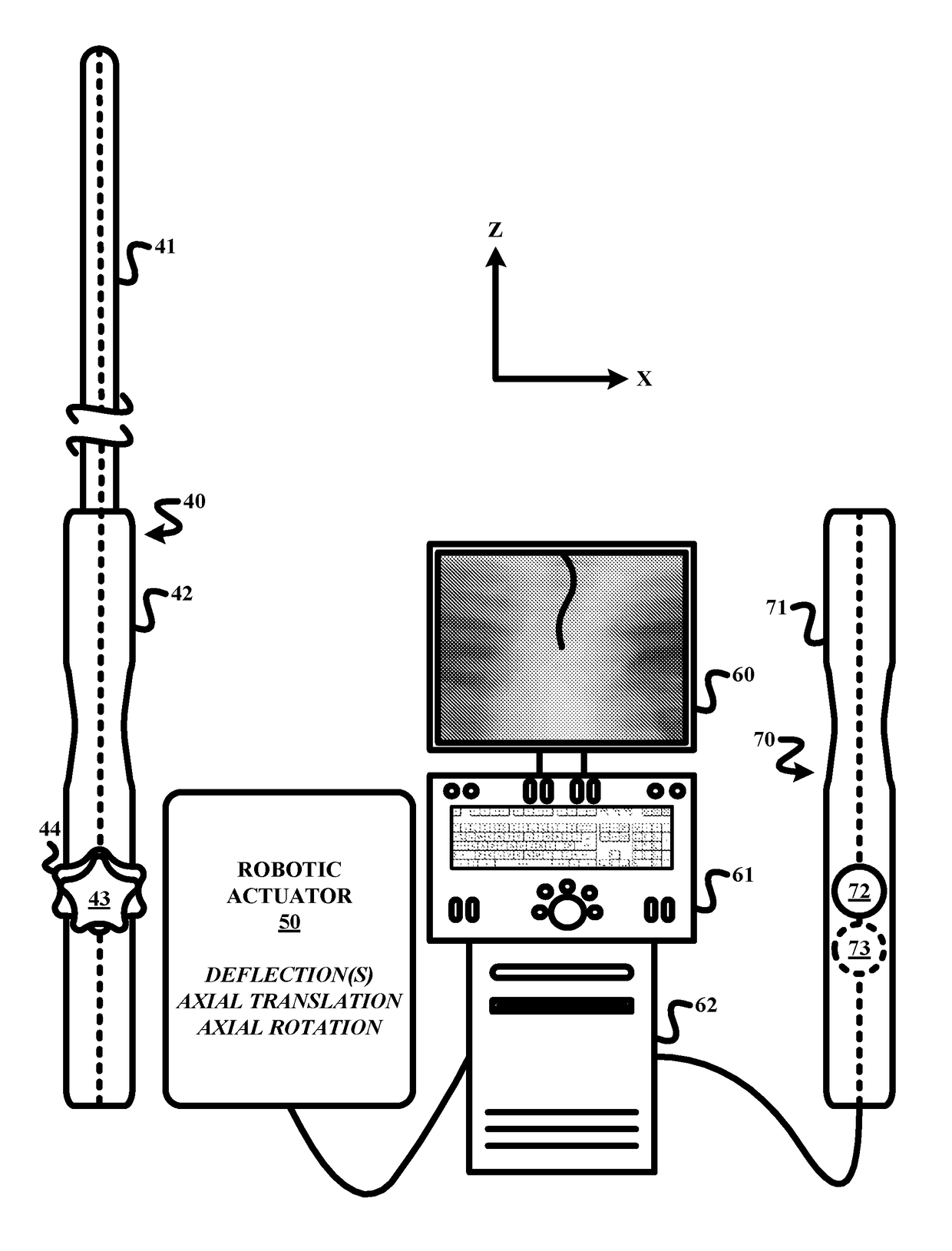Remote robotic actuation of a transeopagel echocardiography probe