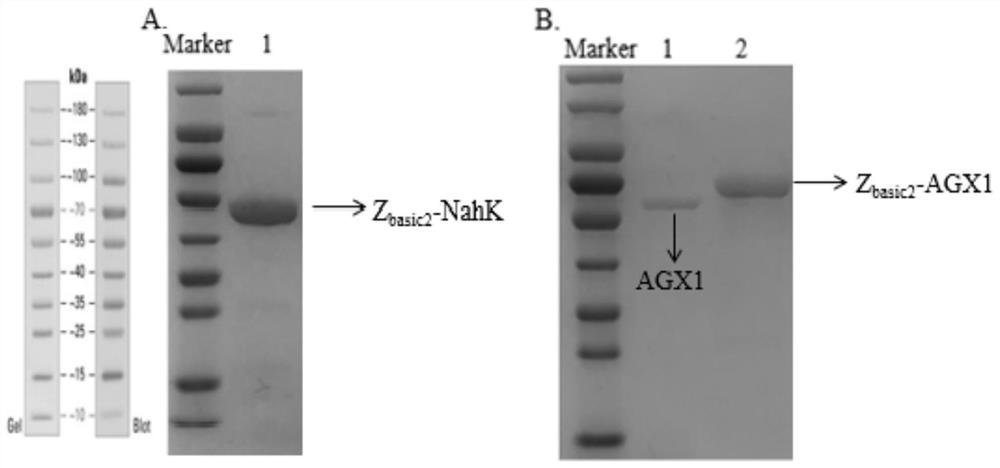 Double-enzyme co-immobilization synthesis method of uridine diphosphate-N-acetylglucosamine and derivatives thereof