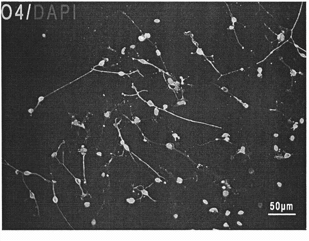 Induction medium for inducing neural stem/progenitor cells to be differentiated into oligodendrocyte precursor cells and induction method and application thereof