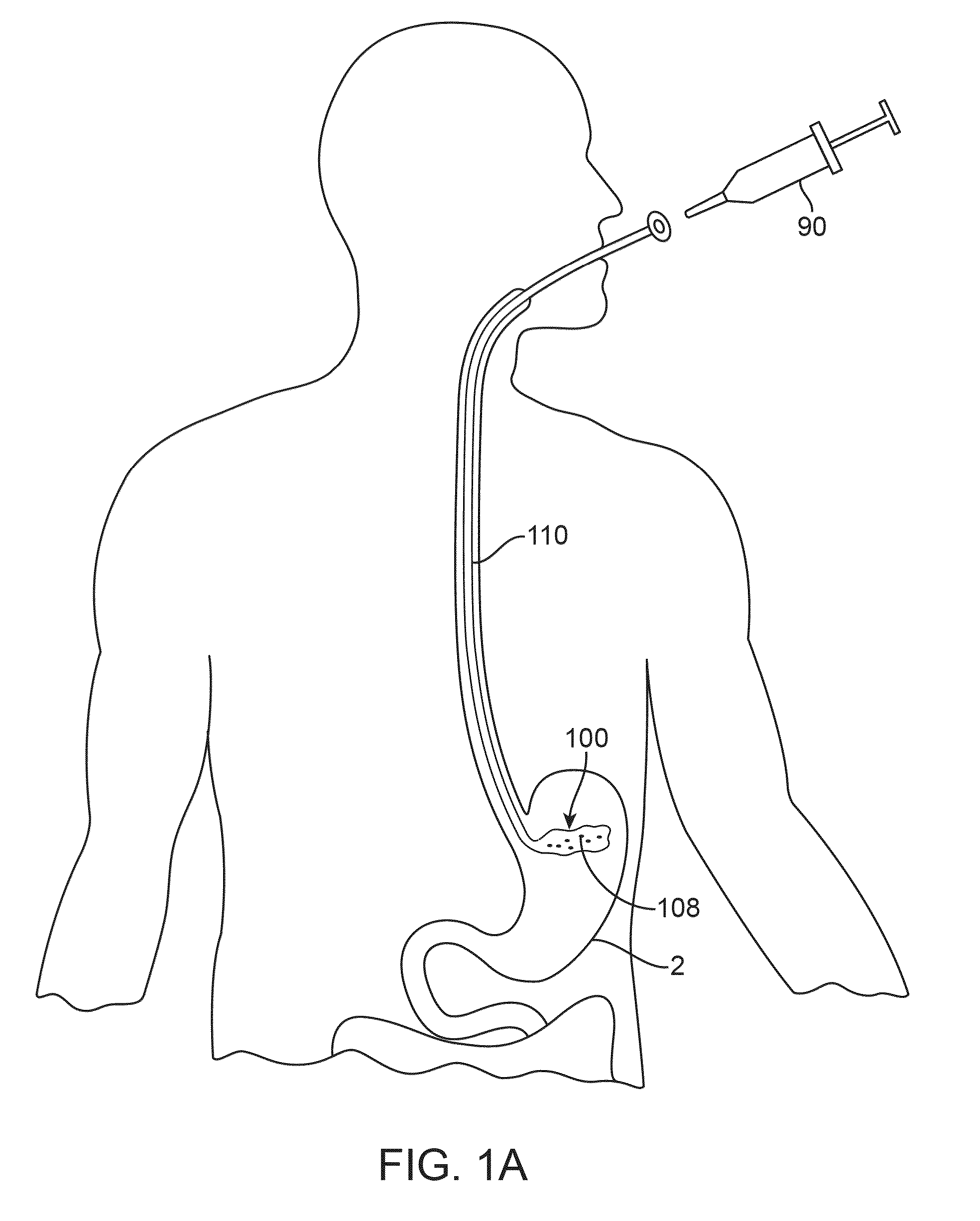 Anatomically adapted ingestible delivery systems and methods