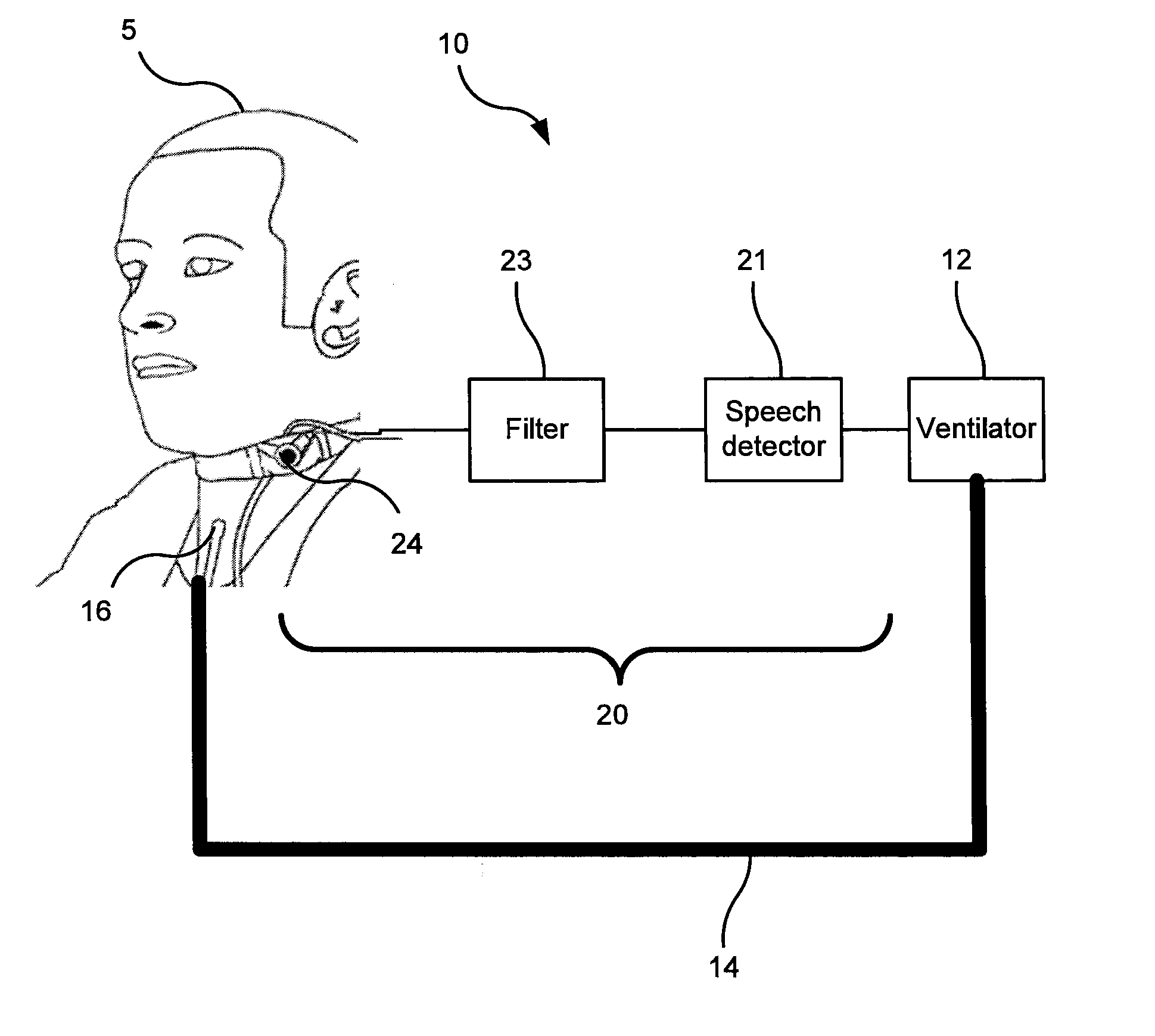 Breathing assistance system with speech detection