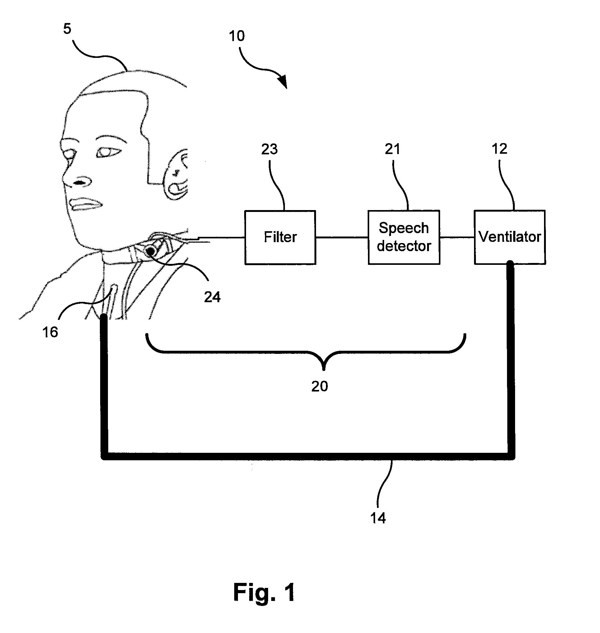 Breathing assistance system with speech detection