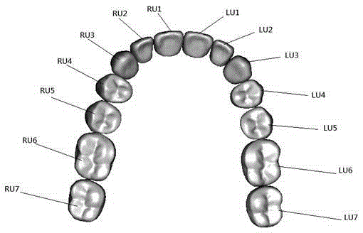 Tooth arrangement method for manufacturing complete dentures