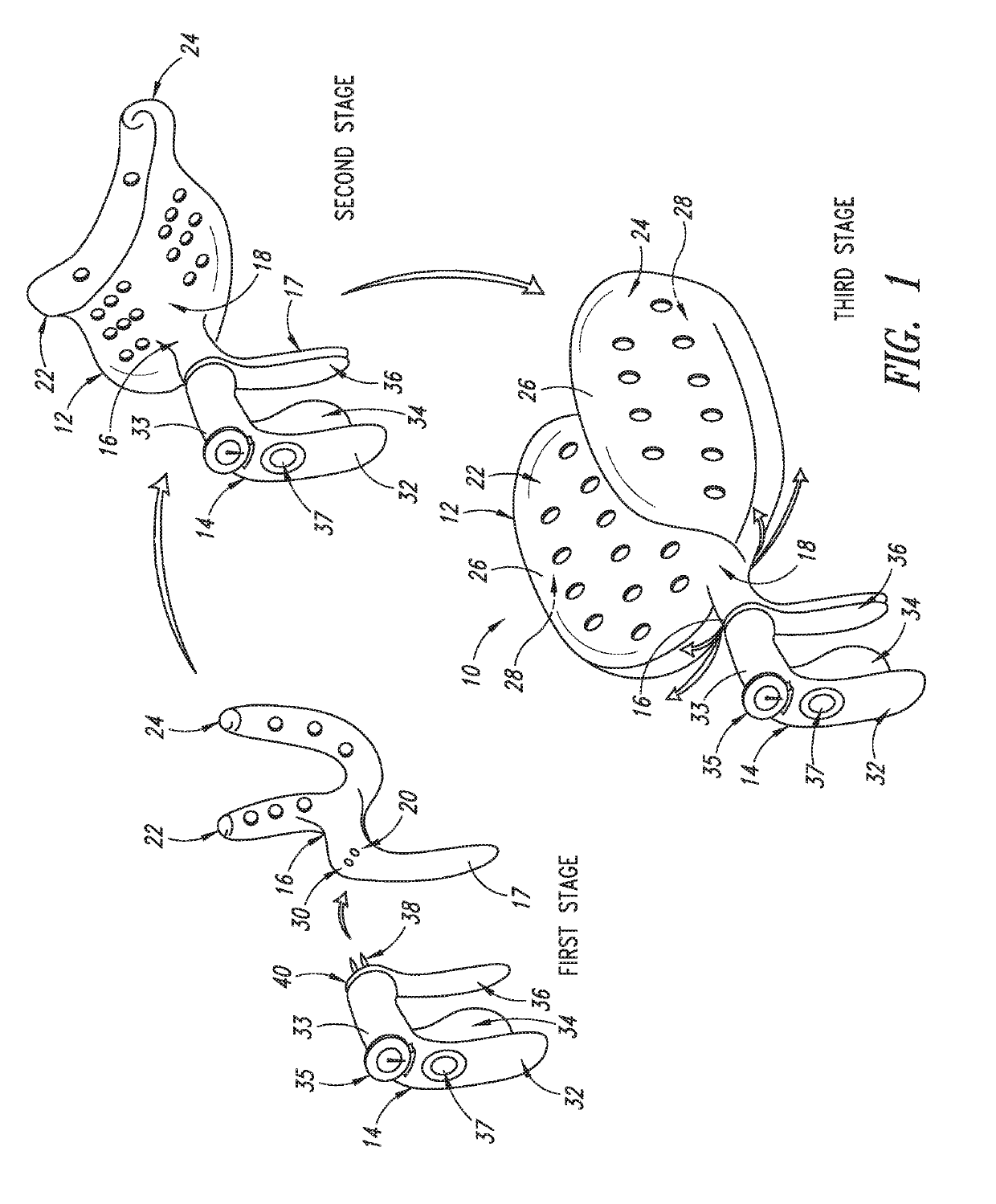 Apparatus to protect the pelvic floor during vaginal childbirth