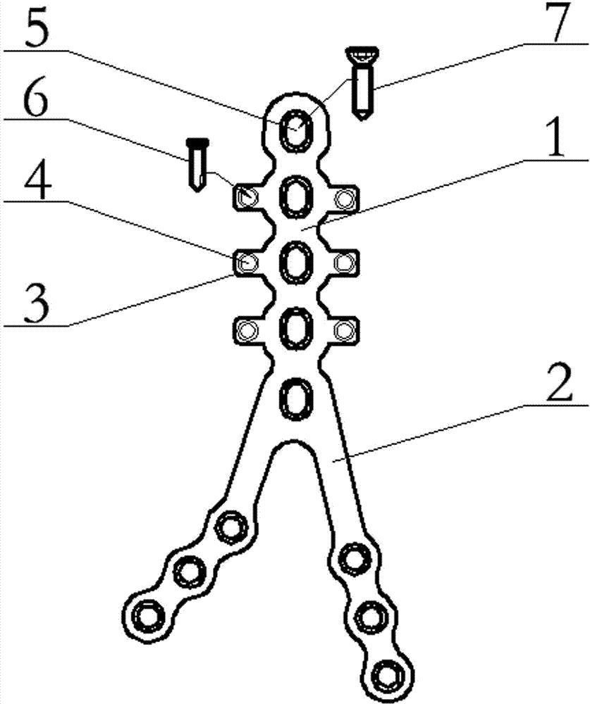 Humerus Y-type protection steel board