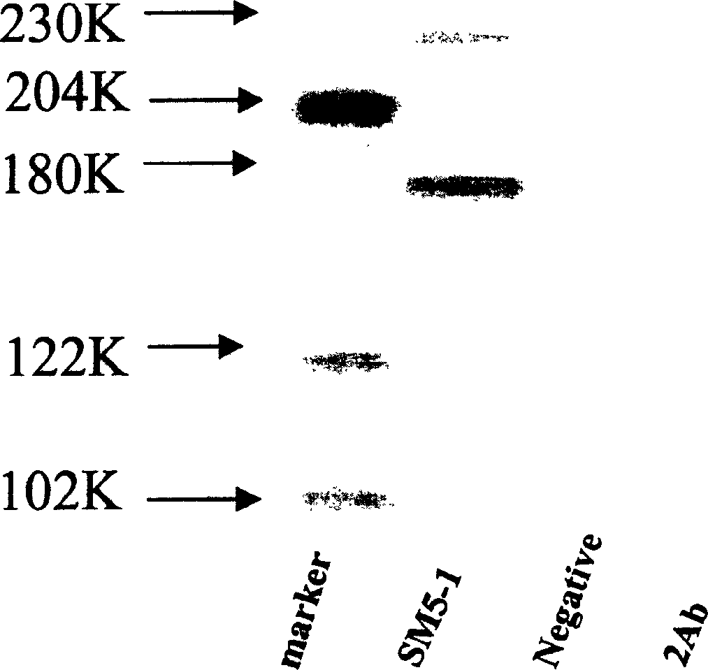 Specific antibody of tumor-associated antigen SM5-1 and use thereof