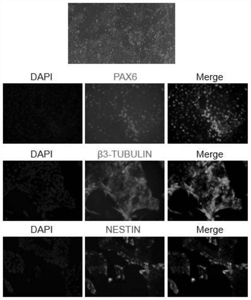 A method for differentiating human pluripotent stem cells to ectoderm