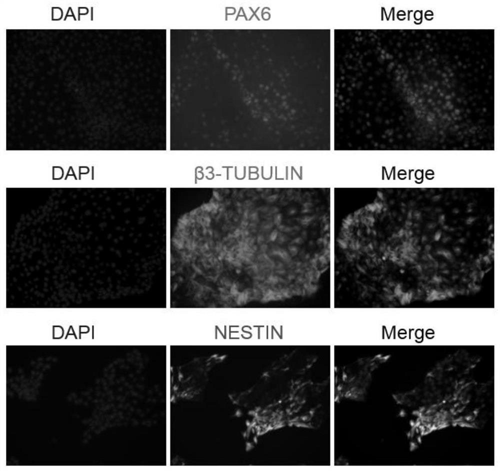 A method for differentiating human pluripotent stem cells to ectoderm