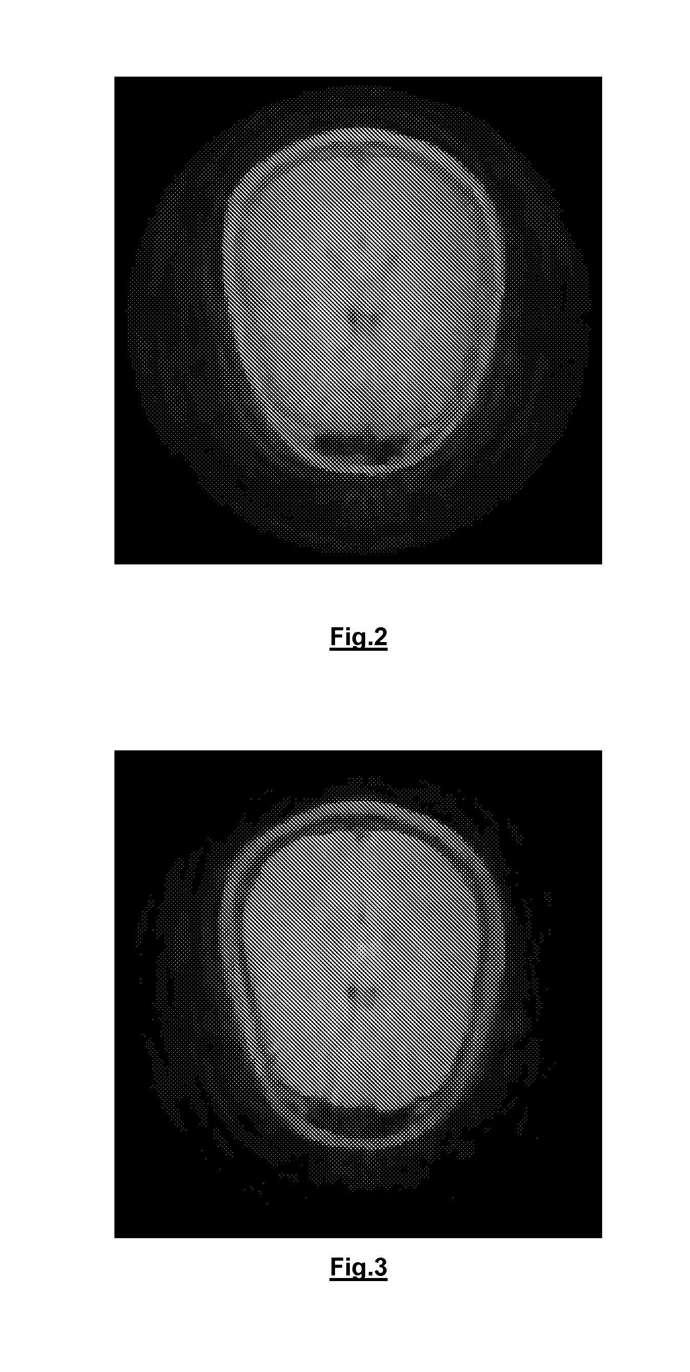 Method and assembly for correcting a relaxation map for medical imaging applications