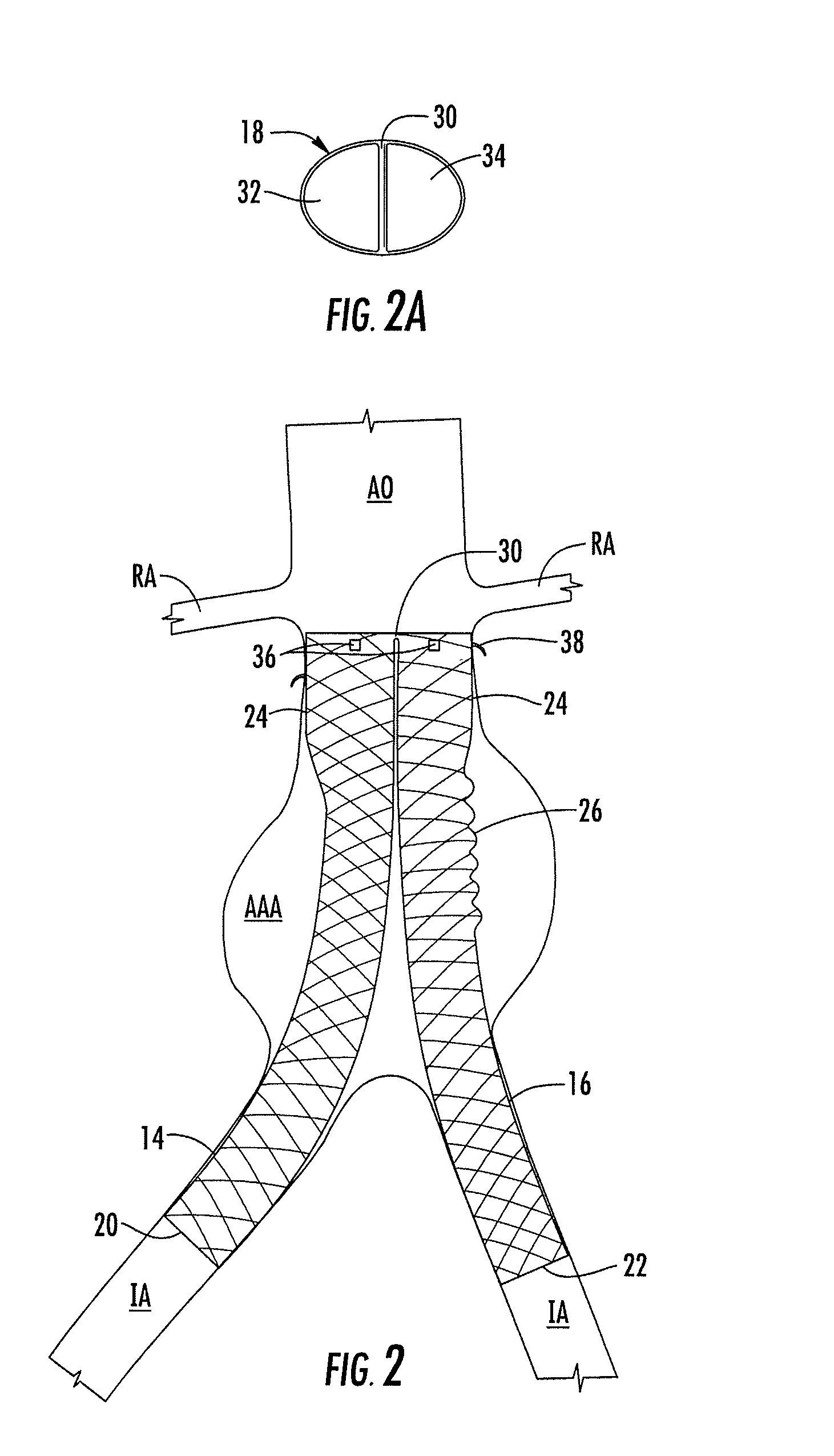 Bifurcated medical device for treating a target site and associated method