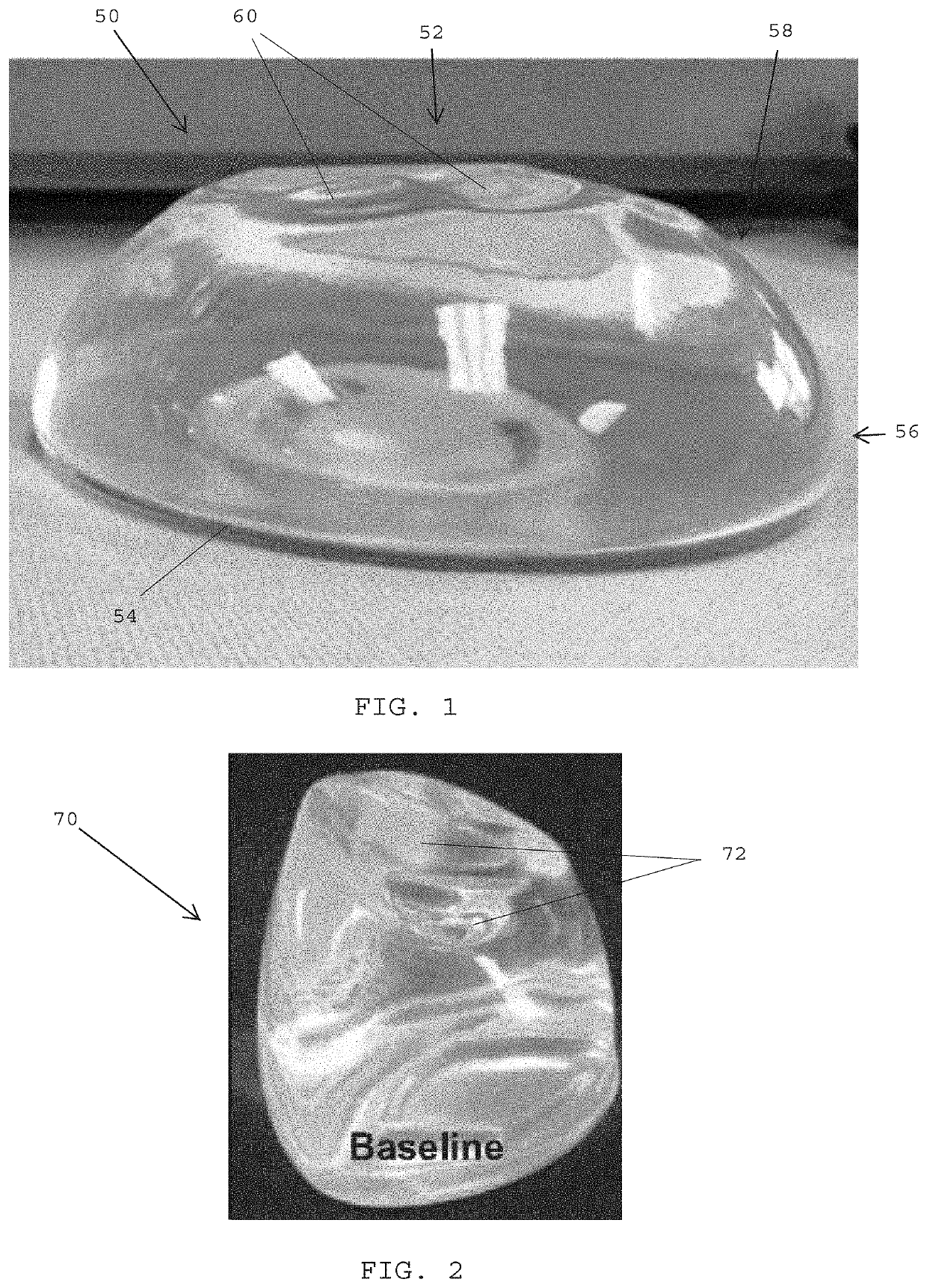 Systems, devices and methods of making mammary implants and tissue expanders having ribbed shells