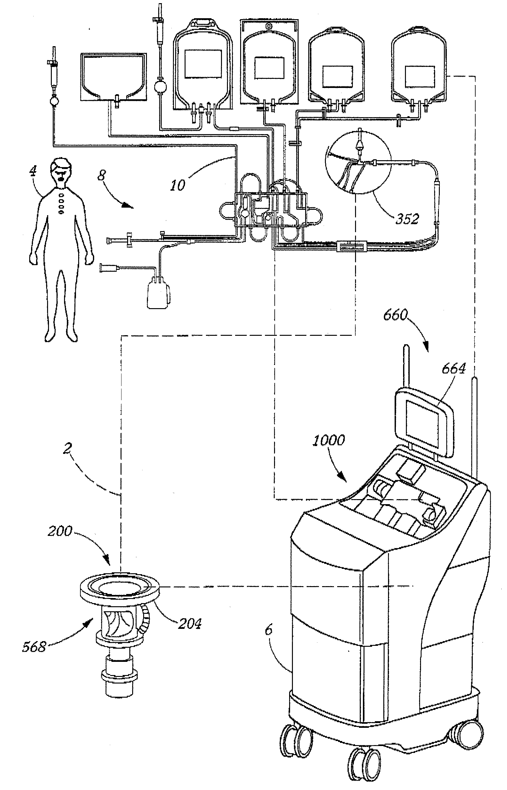 Extracorporeal Blood Processing Methods With Return-Flow Alarm