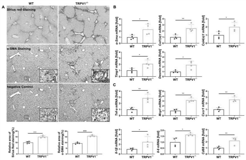 Application of TRPV1 in screening or preparing medicine for preventing, relieving and/or treating liver diseases