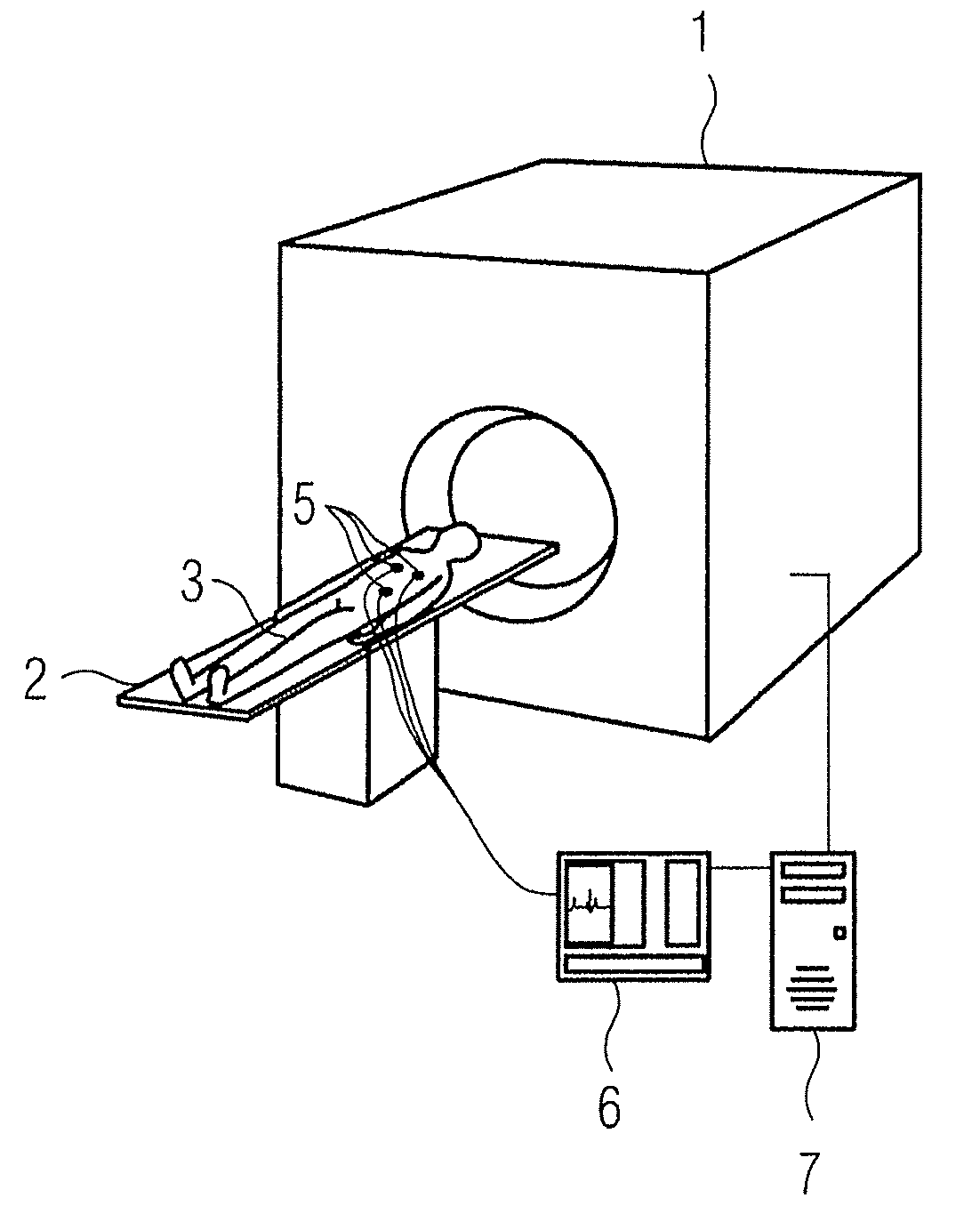 Method and magnetic resonance tomography apparatus for triggered acquisition of magnetic resonance data