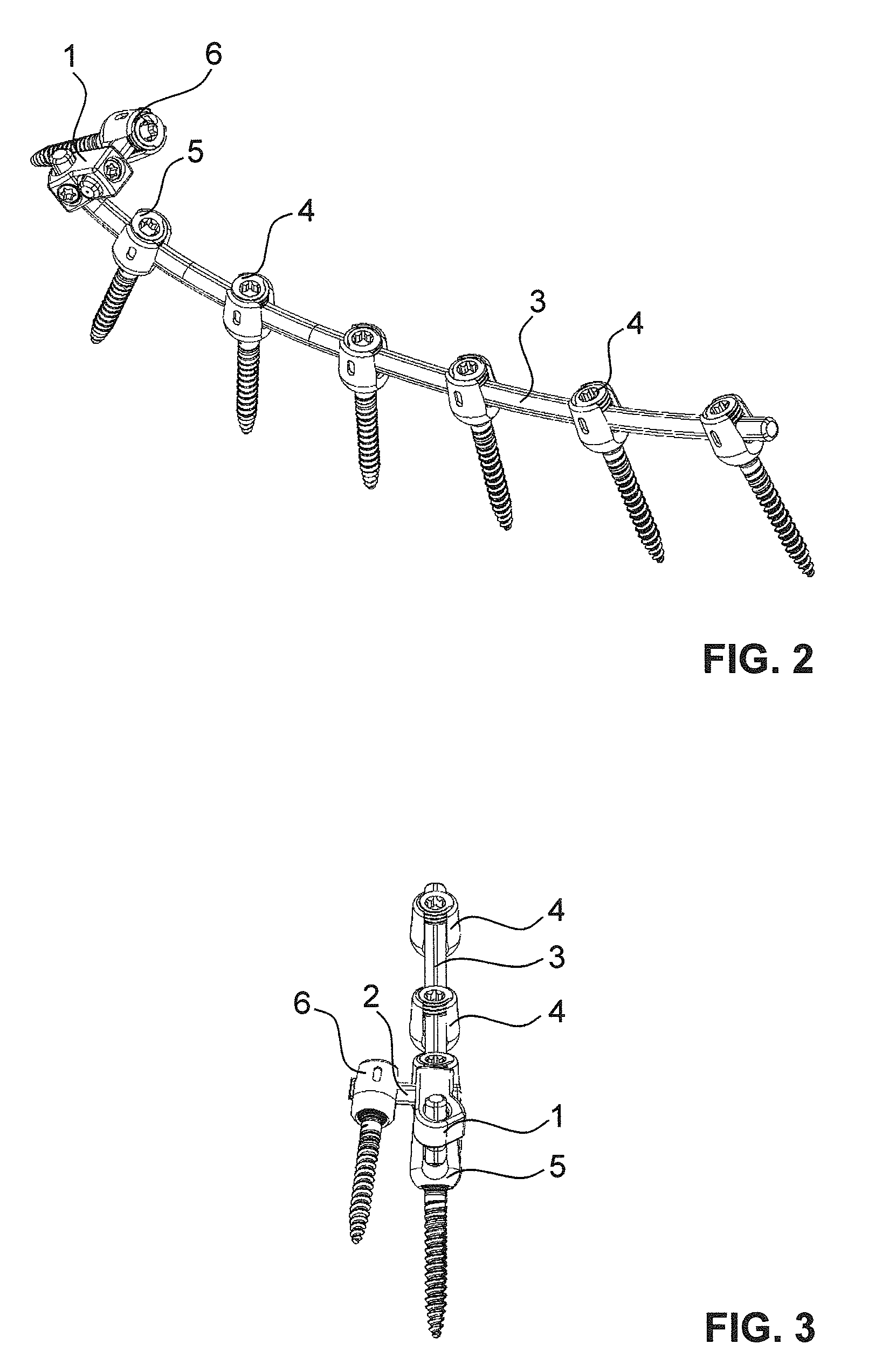 Iliac connector, connector head, spinal fixation system and method of stabilizing a spine