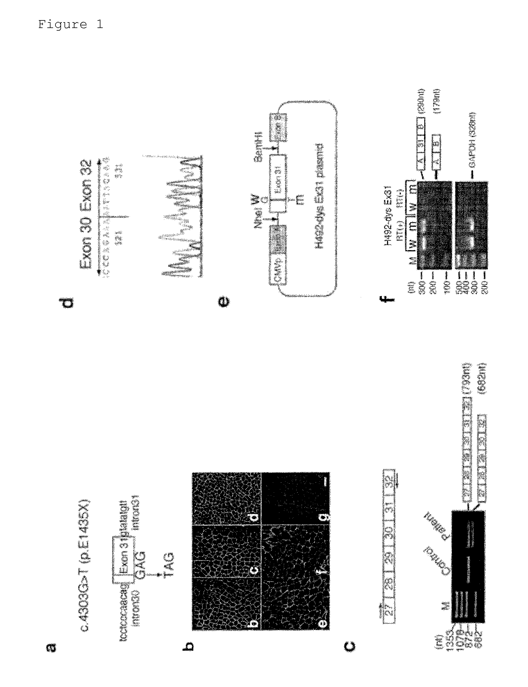 Prophylactic or ameliorating agent for genetic diseases