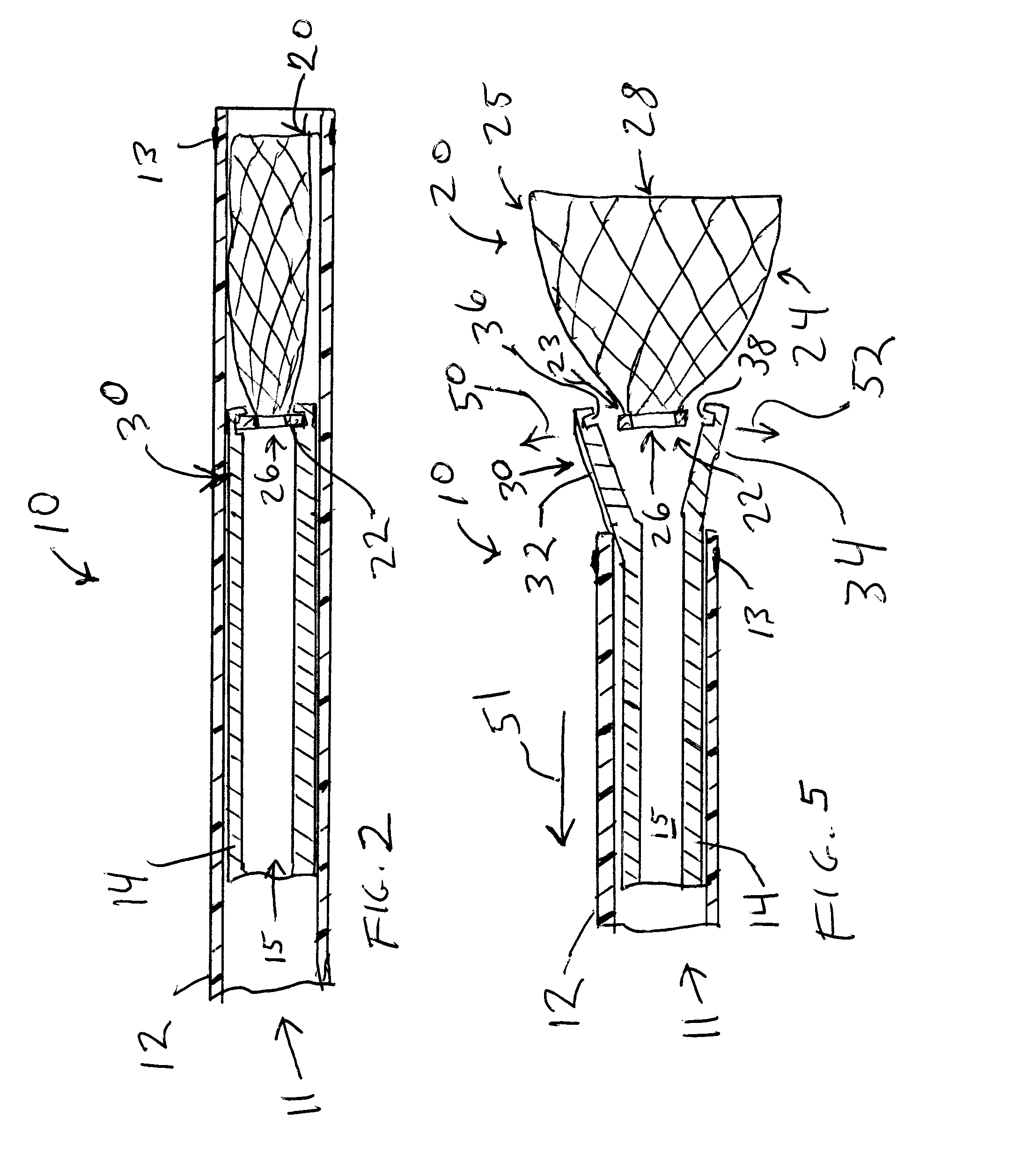 Aneurysm occlusion device